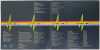 PINK FLOYD - THE DARK SIDE OF THE MOON LP (ORIGINAL UK 'SOLD BLUE' COPY - SHVL 804) - 4
